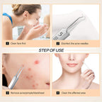 📢📢 50 %  OFF !! ⏰Blackhead Removal Tweezers for Beauty Salons