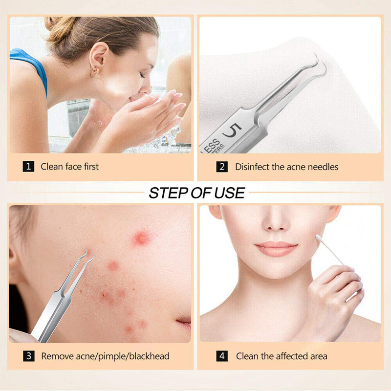 📢📢 50 %  OFF !! ⏰Blackhead Removal Tweezers for Beauty Salons