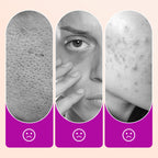 💗 BUY 1 GET 1 FREE!!💗Flawless Brightening Under Eye Concealer