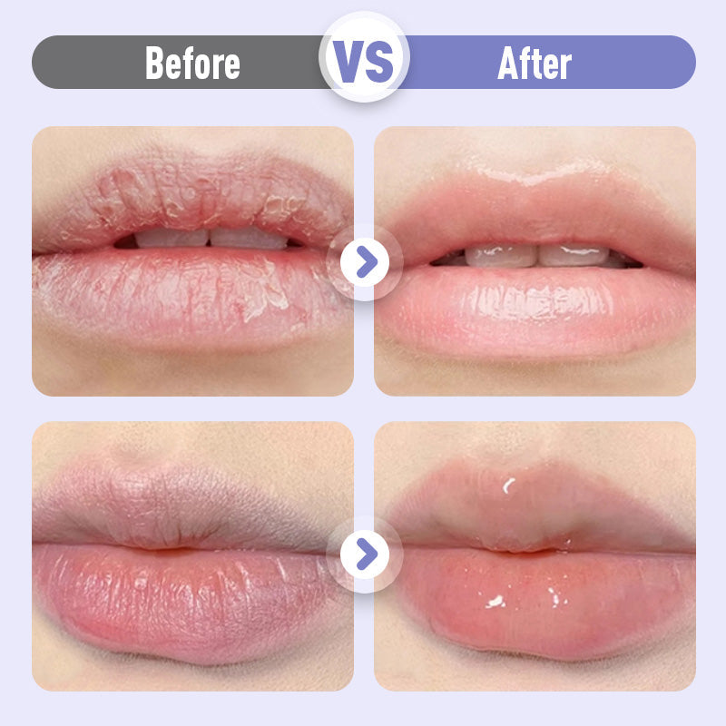 Plumping & Anti-Wrinkle Hydrating Lip Serum💧💋