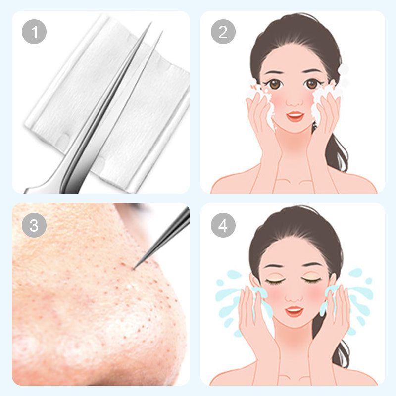 💓HOT SALE 70% OFF💥Stainless Steel Blackhead Removal Kit (with free alcohol pads)
