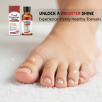 📢📢50 % OFF !!🎅Nail Repair Essence for Damaged Nails