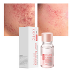 Today Only🎉Buy 1 Get 1 Free💆‍♀️Salicylic Acid Acne-Fighting Essence Toner