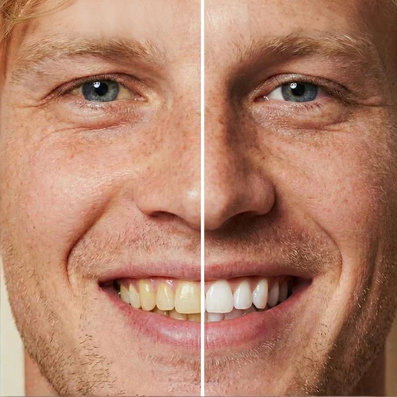 🏆2026 New Arrivals - 50% Off!🧴Instant Whitening Tooth Paint